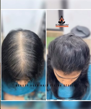 Hair Transformation 5
